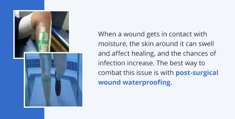 How to Waterproof a Wound for Swimming - A Complete Guide